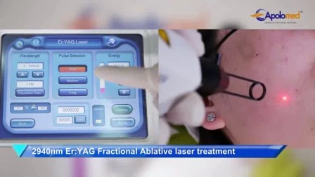 1064 Long Pulse Hair Removal Laser Medical CE Approved 8 em 1 Multifuncional IPL RF Elight Q-Switch ND YAG Laser Machine para remoção de pêlos e remoção de tatuagem